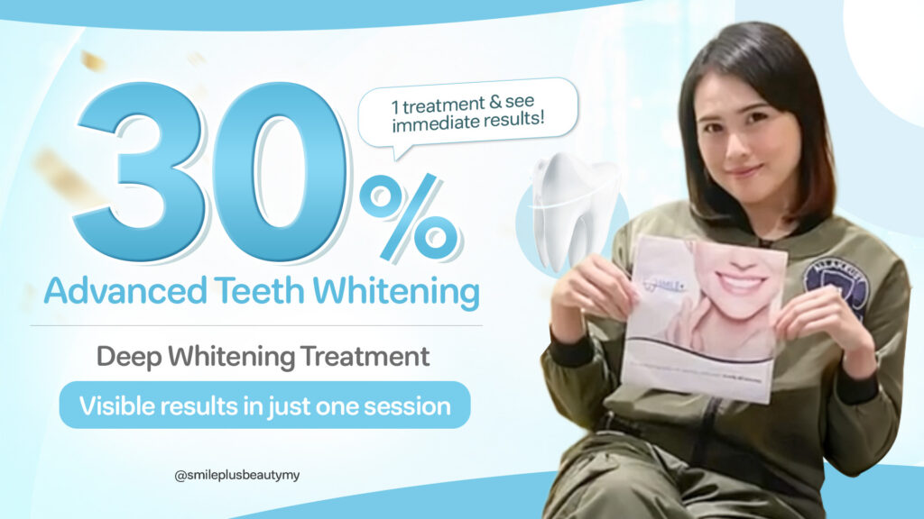 SmilePlus 30 off promotion english